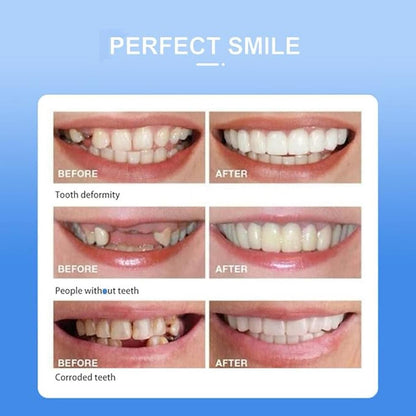 Snap On Veneers Teeth  Instant Perfect Smile Veneers  Comfortable Fit Dentures